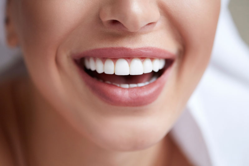 wisdom teeth patient smiling